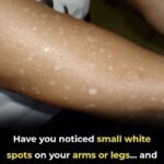 THESE SEEDS DESTROY EVEN THE DEADLIEST DISEASE