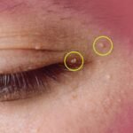 People vaccinated against COVID-19 may be sick…