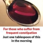 Dry Mouth Is Not Aging — It’s Your Saliva Shutting Down