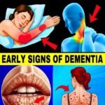 Pancreatic cancer: these 10 signs that can help you detect it (don’t ignore them)… See more