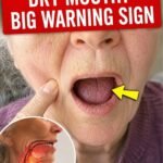 Alert! 8 Drugs That Cause Serious Dementia