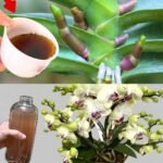 23 Strange Signs Your Kidneys Might Be in Trouble