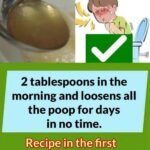 If you have a heart attack at home, do this in 10 seconds and you can save your life.(1 / 2)