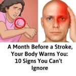 10 Warning Signs of a Blood Clot in the Leg You Should Know