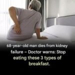 These visible signs may be hiding liver disease