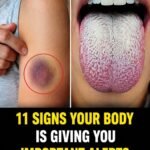 10 Early Warning Signs of a Stroke Everyone Should Know to Take Prompt Action