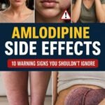 Weird amlodipine side effects that don’t usually get mentioned