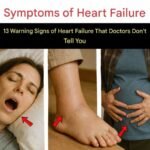 A month before a stroke, your body warns you: 10 signs not to ignore