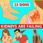 10 Early Warning Signs of a Stroke Everyone Should Know to Take Prompt Action