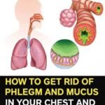 These visible signs may be hiding liver disease