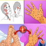 How to Get Rid of Phlegm and Mucus in Chest and Throat Naturally