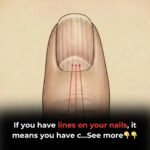 Pain On The Left Side Of The Body: What it could mean?