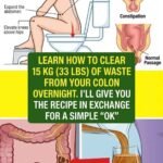 12 Worst Side Effects of Amlodipine You Should NEVER Ignore!