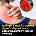 7 medications that cause severe dementia and profound brain damage
